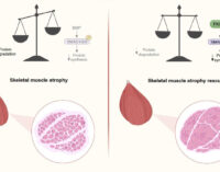 RICERCATORI DELL’UNIVERSITÀ DI TORINO IDENTIFICANO DUE PROTEINE COINVOLTE  NELLA CACHESSIA NEOPLASTICA